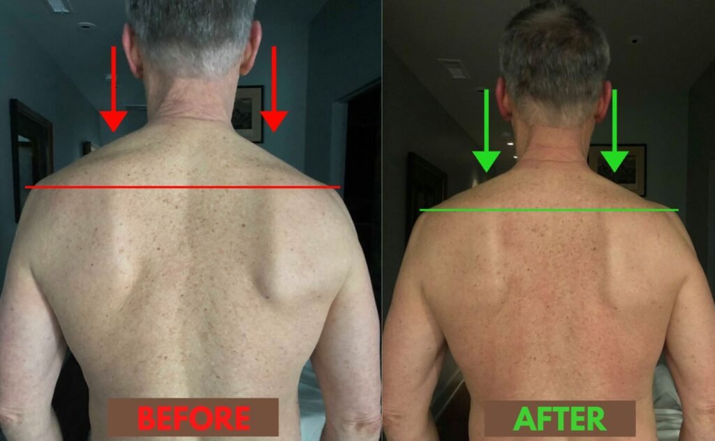 Client back and shoulder posture improvement after in-home massage in the DMV